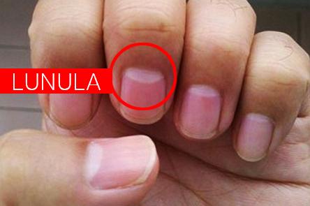Lunula atau Bulan Sabit di Kuku Bisa Deteksi Kondisi Kesehatan