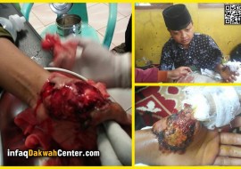 Santri Korban Tabrak Ini Remuk Telapak Tangannya. Ayo Bantu Biaya Operasi!